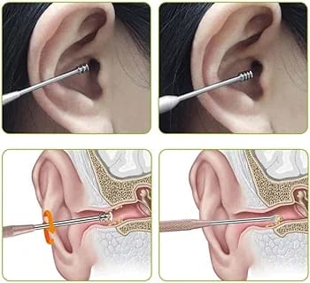 Ear Cleaning Tool Set